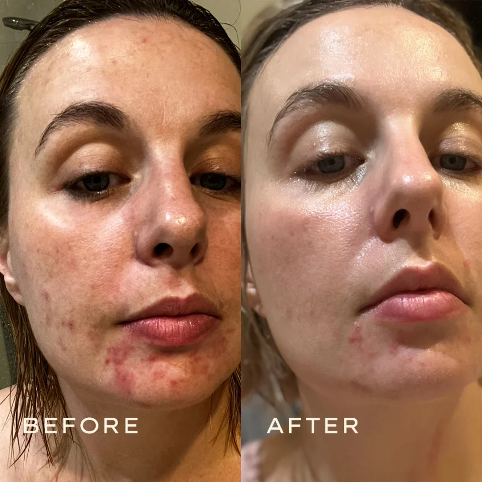 Calendula Cream - Image 9