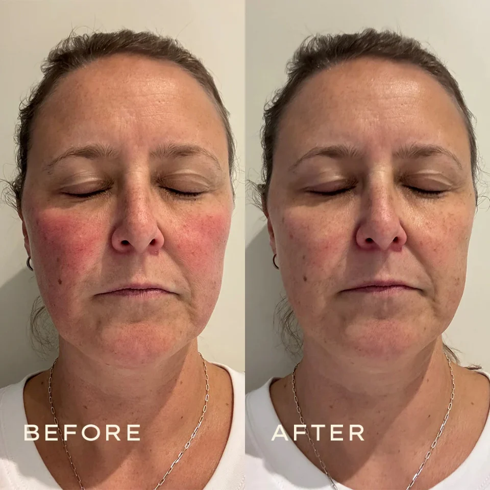 Calendula Serum - Image 8